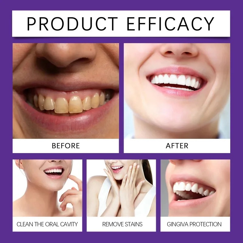 Fioletowy proszek mineralny do – Teeth Whitening Near Me recenzja i cena