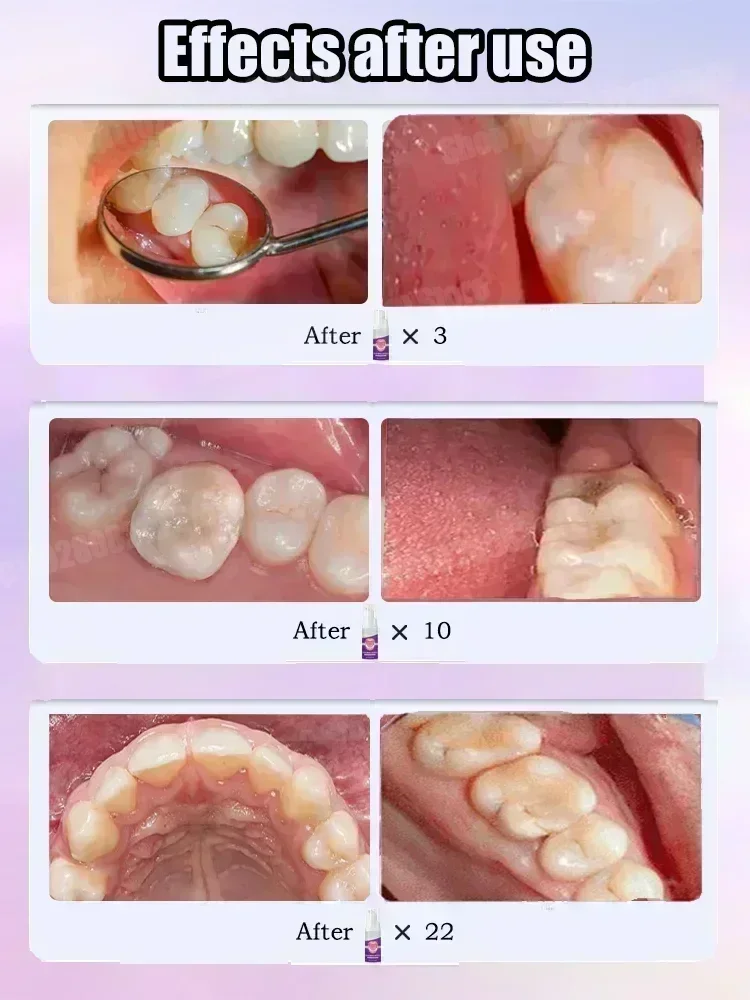 Pasta do czyszczenia zębów usu – Teeth Whitening Kit recenzja i cena