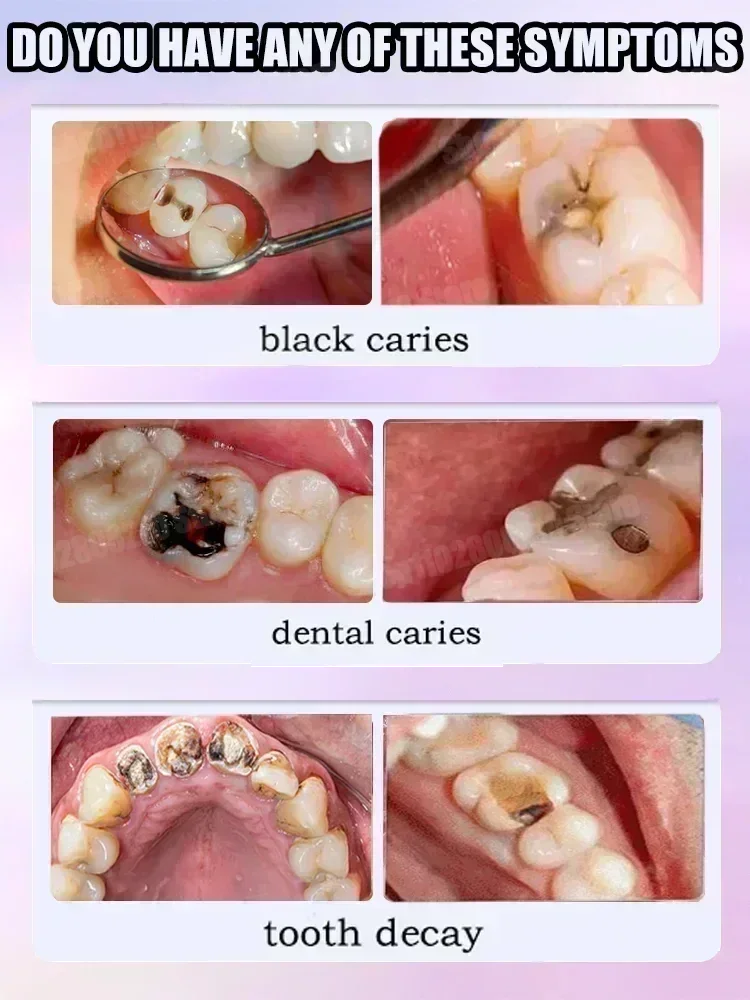 Pasta do czyszczenia zębów usu – Teeth Whitening Kit recenzja i cena